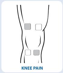TENS Unit Electrode Placement Guide - prohealthcareproducts.com