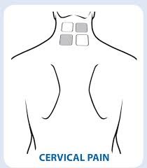 https://www.prohealthcareproducts.com/product_images/uploaded_images/tens-electrode-placement-for-cervical-pain.jpg