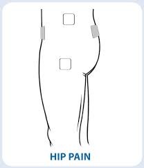 https://www.prohealthcareproducts.com/product_images/uploaded_images/tens-electrode-placement-for-hip-pain.jpg